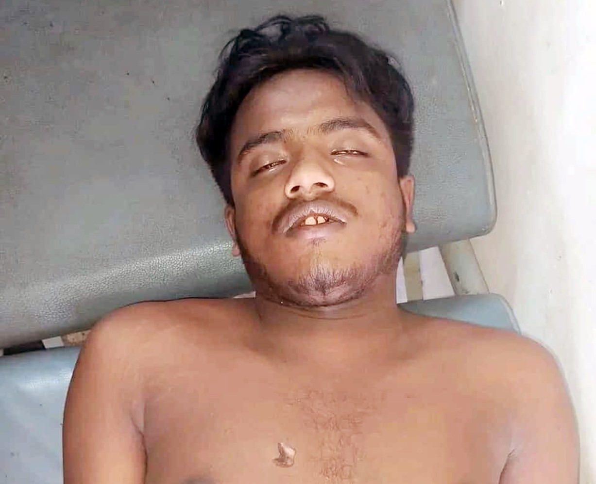 ভোলায় বিদ্যুৎস্পৃষ্ট হয়ে যুবকের মৃত্যু